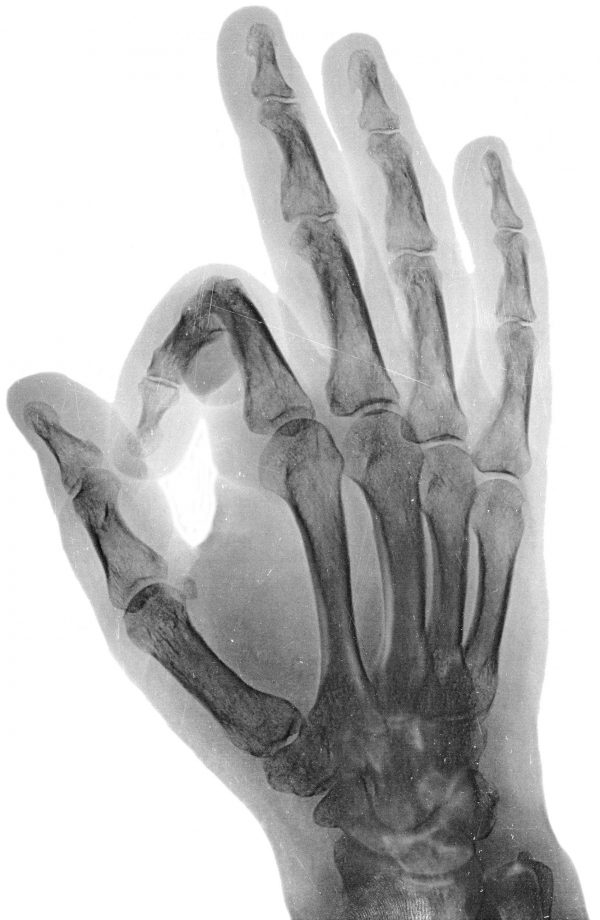 Modelo Radiografía OK